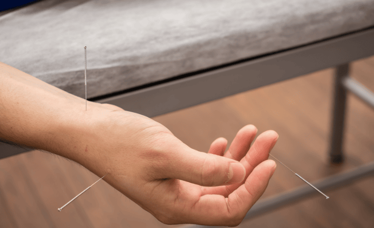 Hội chứng ống cổ tay