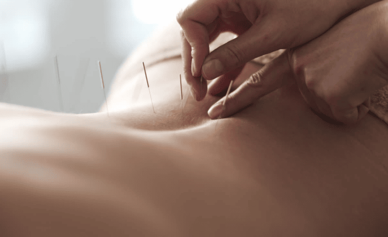 Đau thần kinh tọa