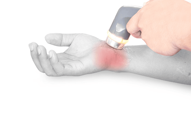 Hội chứng ống cổ tay