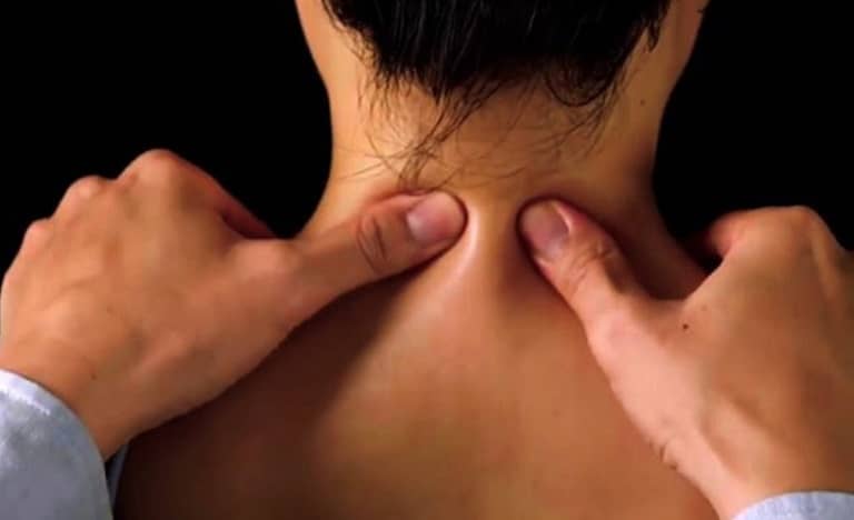 châm cứu bấm huyệt trị đau cổ vai gáy